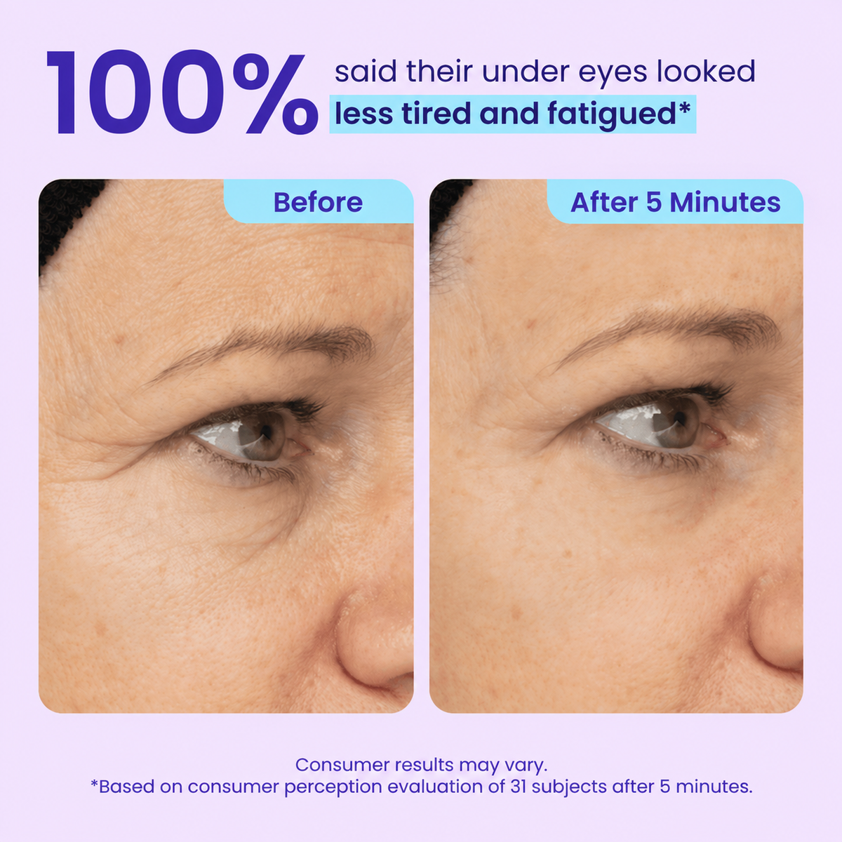 LOVILDS™ 3-in-1 Instant Lift Eye Gel