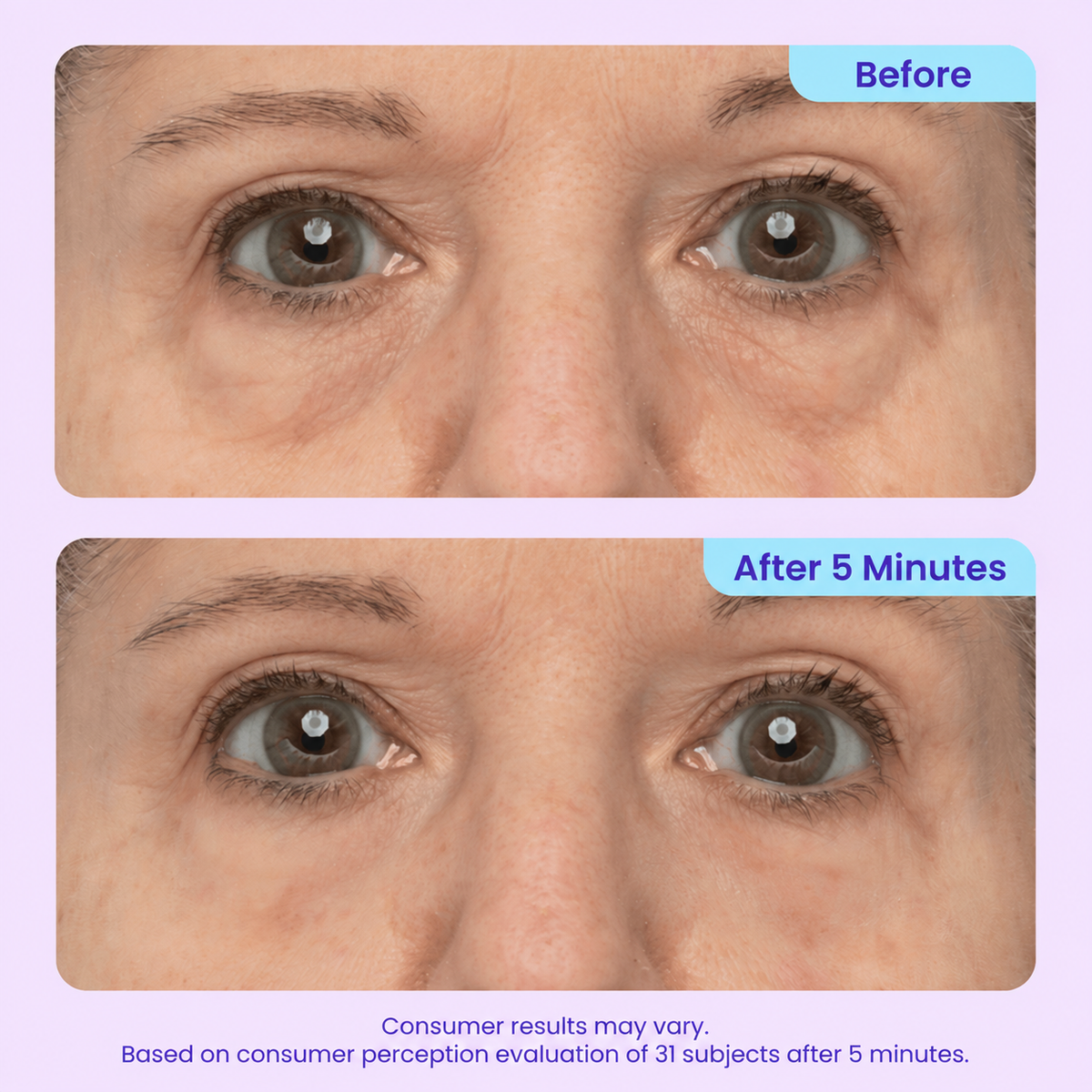 LOVILDS™ 3-in-1 Instant Lift Eye Gel